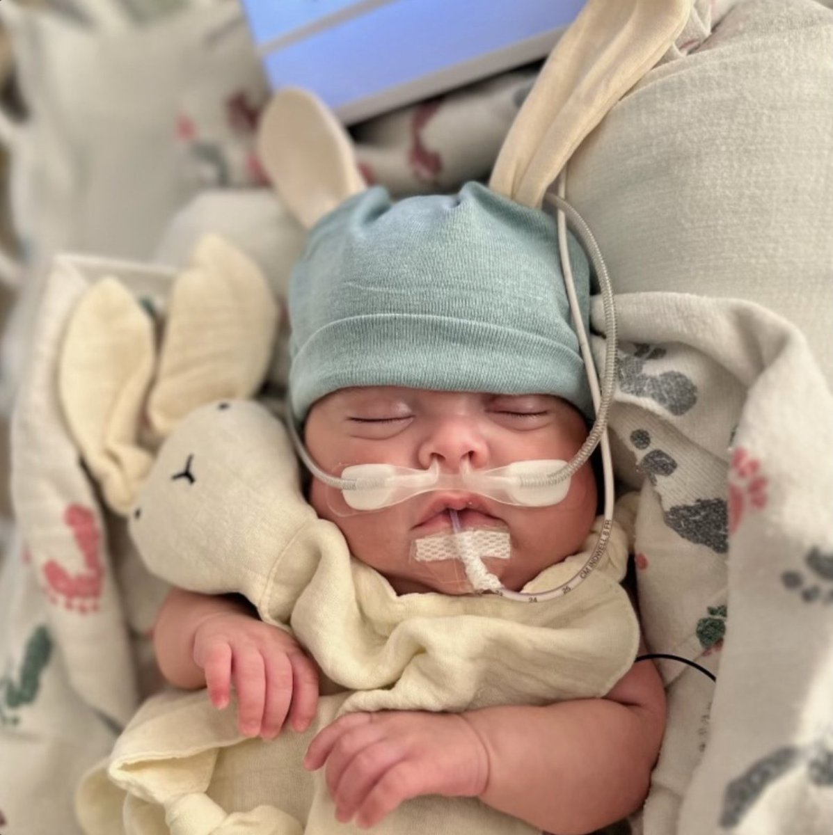 Meet Kylo! 💙 While in the NICU at a nearby hospital, his family has received essential support and services at @RMHCNC. To learn more about our impact, visit rmhc.org