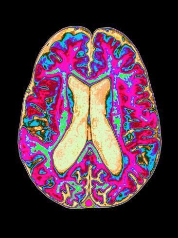How to fix your dopamine-fried brain permanently.

It starts with 1 simple word you use everyday: