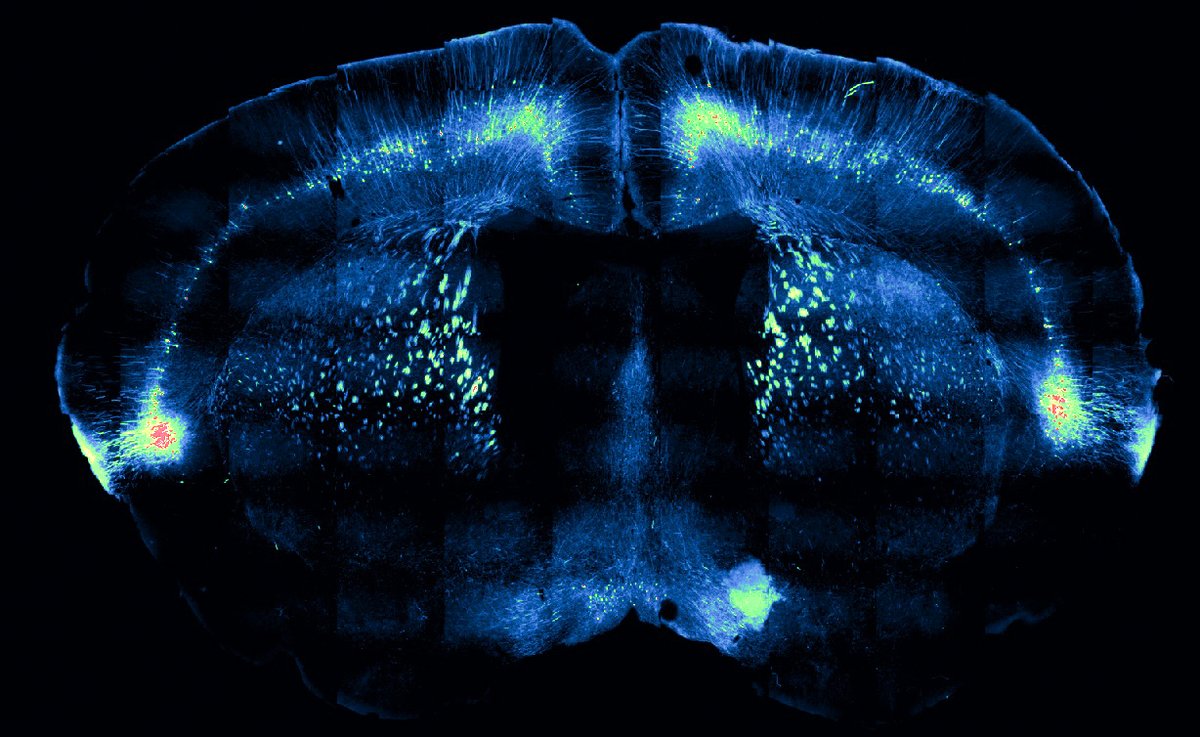 📸 La photo du mois est issue des travaux de recherche de l'équipe d’Amaury François, lauréat d'Impulscience® 2022. Chercheur en #neurosciences à l'@IGF_Montpellier, Amaury (@Doctor_Amaury) cartographie les circuits neuronaux qui relient le toucher aux émotions.