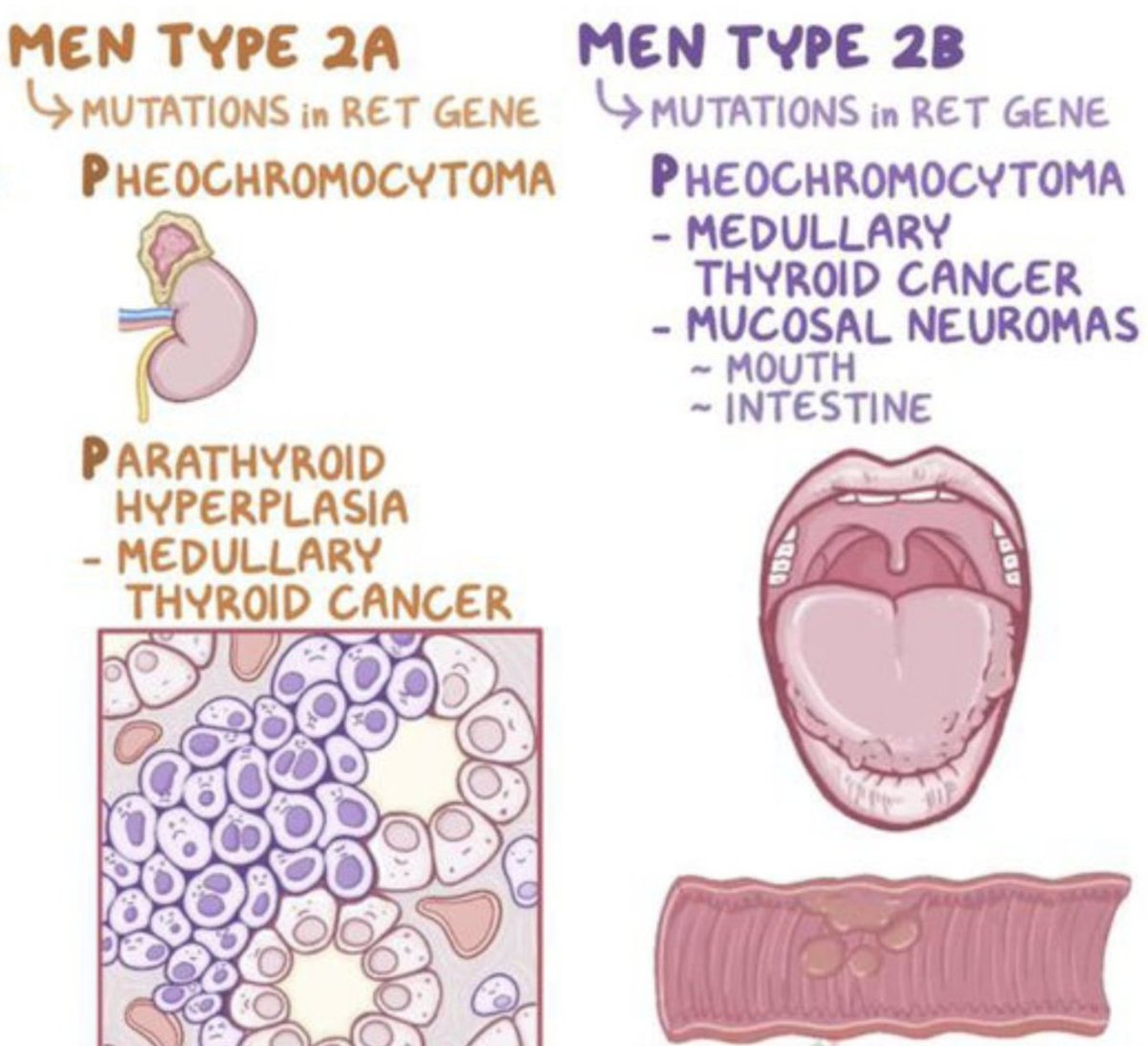 Pheochromocytoma associated w/ MEN 2 - rare, genetic, endocrine gland tumors in thyroid gland, parathyroid glands & adrenal glands; Cause: RET mutation; 3 subtypes (MEN2A, MEN2B, FMTC); MEN2: medullary thyroid cancer,  pheochromocytoma, parathyroid gland cancer