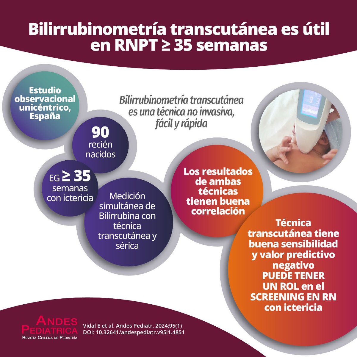 CORRELACIÓN ENTRE BILIRRUBINOMETRÍA TRANSCUTÁNEA Y BILIRRUBINA SÉRICA EN RECIÉN NACIDOS ≥ 35 SEMANAS Este artículo original destaca por la excelente sensibilidad y valor predictivo negativo respecto de otros estudios similares. Te invitamos a leerlo >>> revistachilenadepediatria.cl/index.php/rchp…