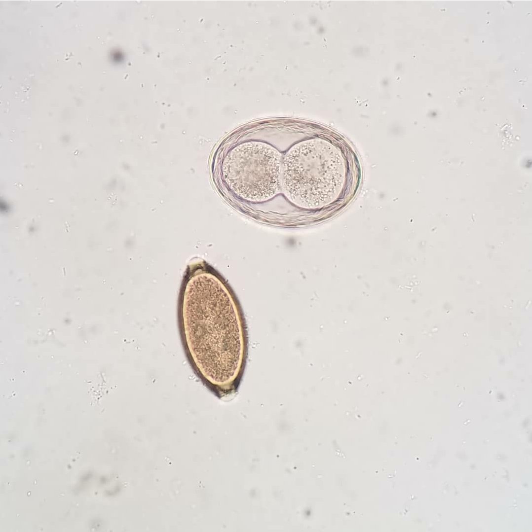 Toxascaris on top and the whipworm Trichuris on bottom. The thick outer shell of Trichuris lets it survive in harsh environments #vettech #veterinary #veterinarymedicine #veterinaria #veterinarytechnician #vetschool #vetnurse #vetstudent #veterinarian #dvm #microscopy #microscope