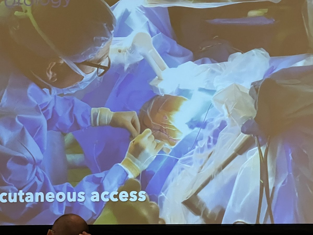 tzevattefik's tweet photo. Democratizing #PCNL access for urologists 

Electromagnetic guided PCNL access #Monarch #RoboticsInEndourology 

Jamie Landman 
#AUA24 https://t.co/4cBWObDKgX