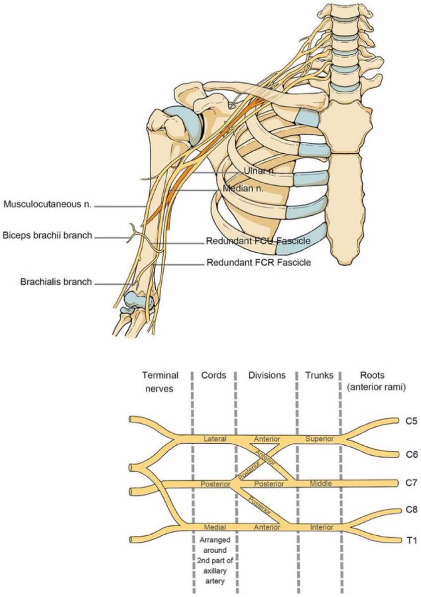 'Brachial Plexus': Anatomical course in the shoulder, neck & upper arm C5/C6 injury👉impaired shoulder & elbow flexion, abduction, external rotation C7 injury👉compromised dexterity in the hands C8/T1' injury👉impaired hand/wrist function #nerve frontiersin.org/journals/neuro…