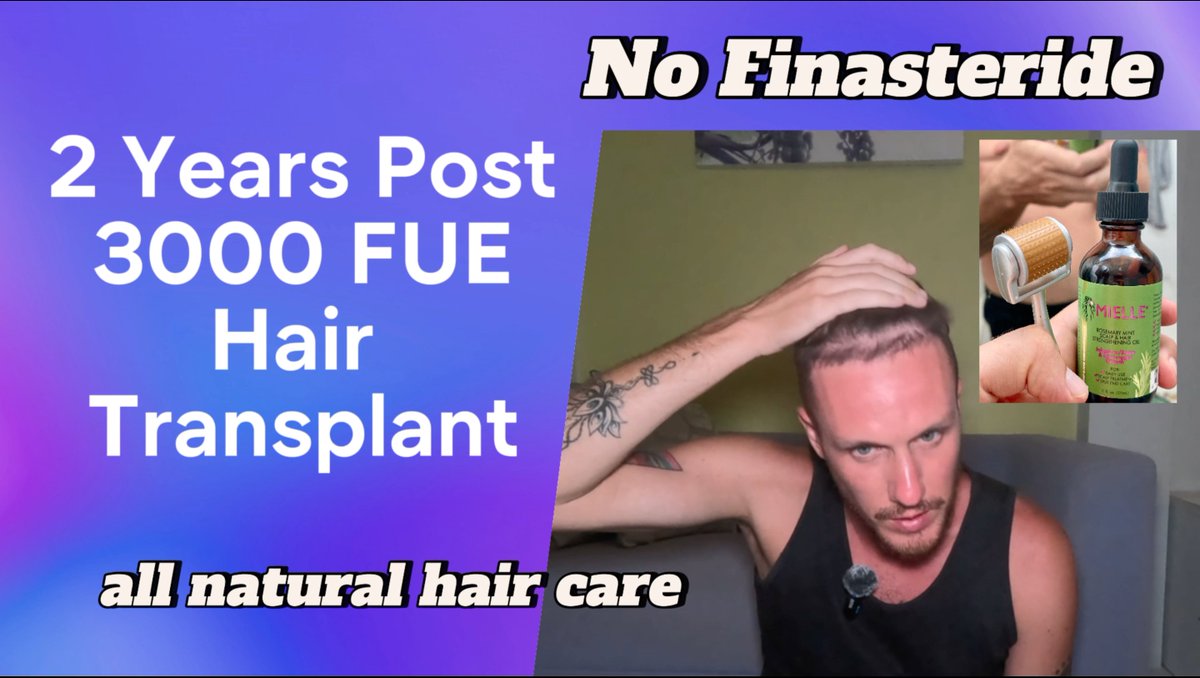 youtu.be/TFKQLuvu5zo?si…

#naturalhaircare #rosemaryoil #hairtransplant