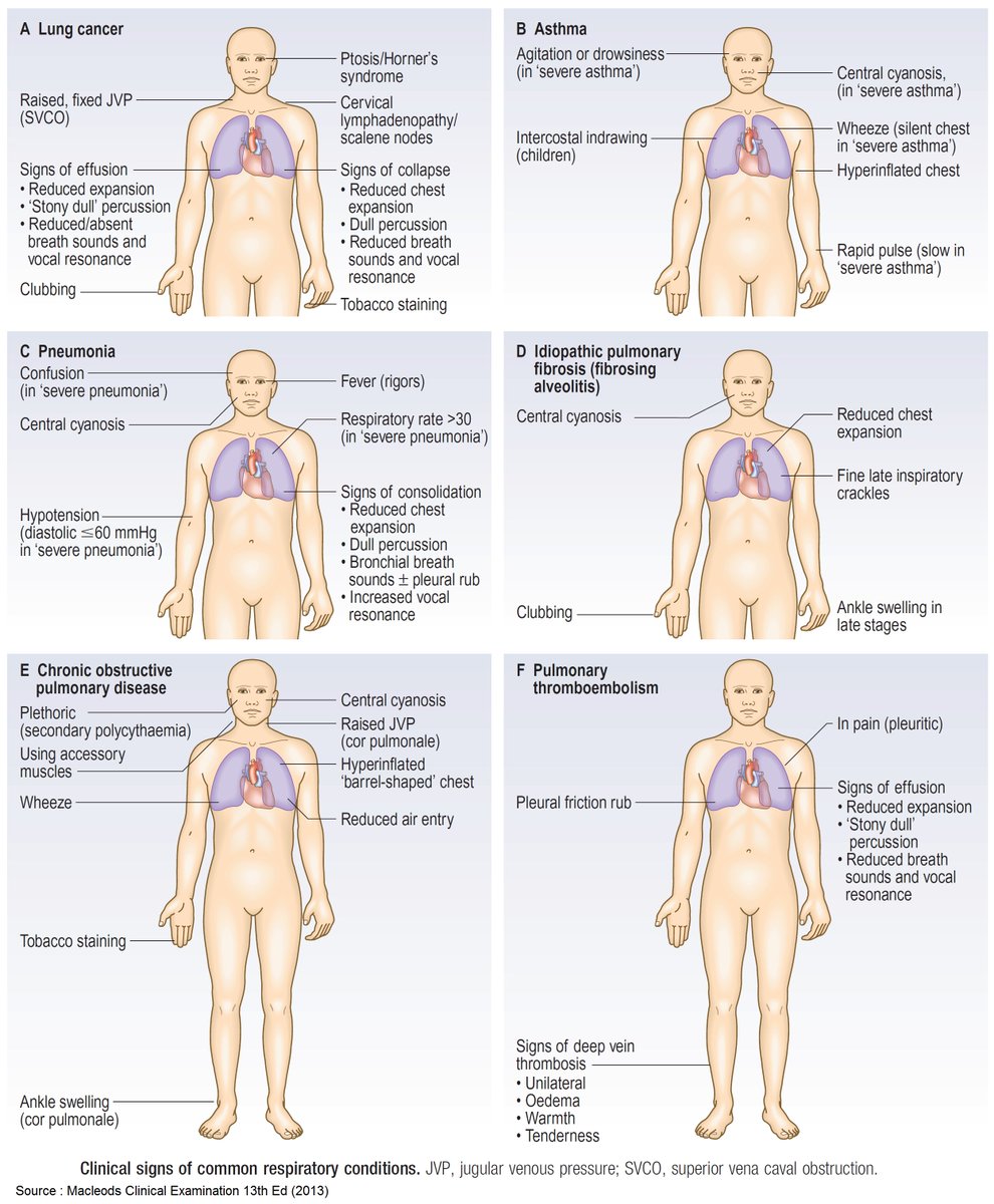 @OGdukeneurosurg Clinical signs of common respiratory conditions