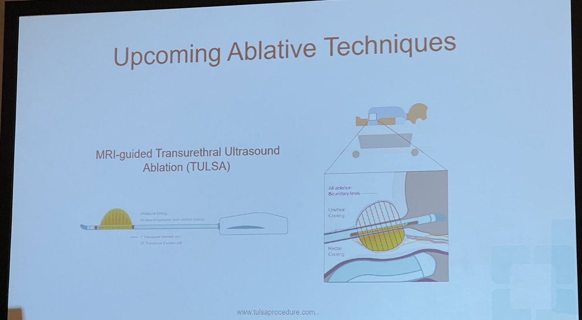 Advances in Tx of BPH by @SmitaDeMD ⏺️MRI guided US ablation ((TULSA) ⏺️Robotic waterjet treatment ⏺️Temporary implanted prostatic device ⏺️Double-lobe prostate baloon All need careful evaluation and counseling @Endo_Society @AmerUrological #AUA24
