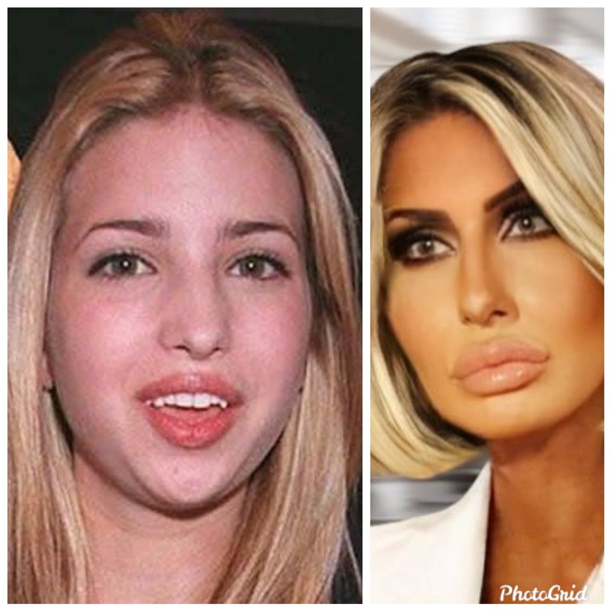 @JebraFaushay @GuntherEagleman Before and after sex with Donald J. Trump Sr. - 45th resident of the White House, perennial whiner, wearer of perpetually full, excrement-leaking diapers, thief of national secrets, sexual abuser of 26 women and girls, business fraudster, serial liar & ra(p/c)ist