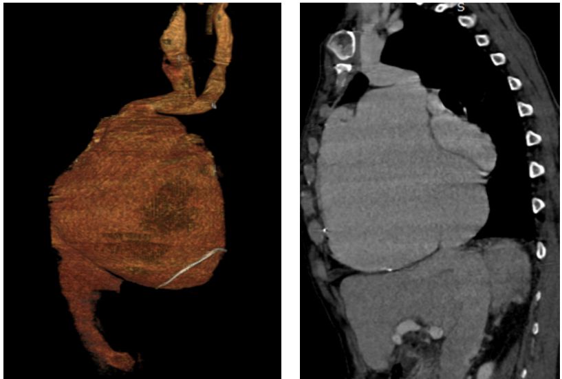 relisysmedical tweet picture