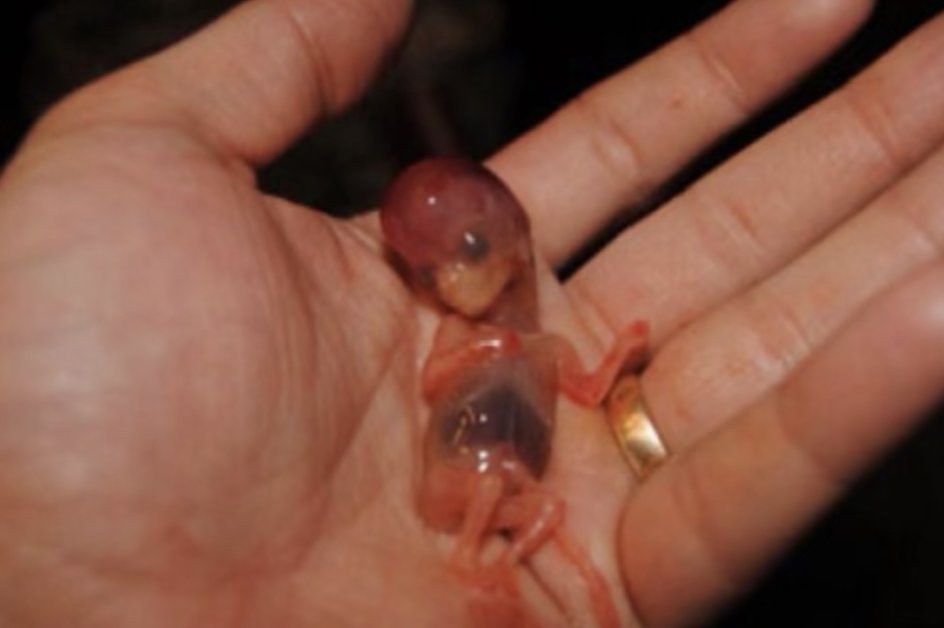 It breaks my heart to look at this photo, but women need to know that if they take the Chemical Abortion Pill, they will painfully give birth to their baby that will look a bit like this, with moving legs and a beating heart... 💔 Women deserve to know the truth.
