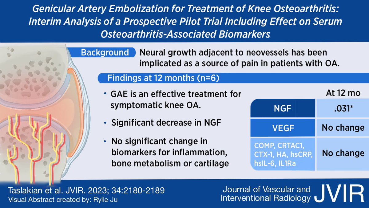 New visual abstract from <a href="/JVIRmedia/">JVIR</a> on an interim analysis of a genicular artery #embolization prospective trial!