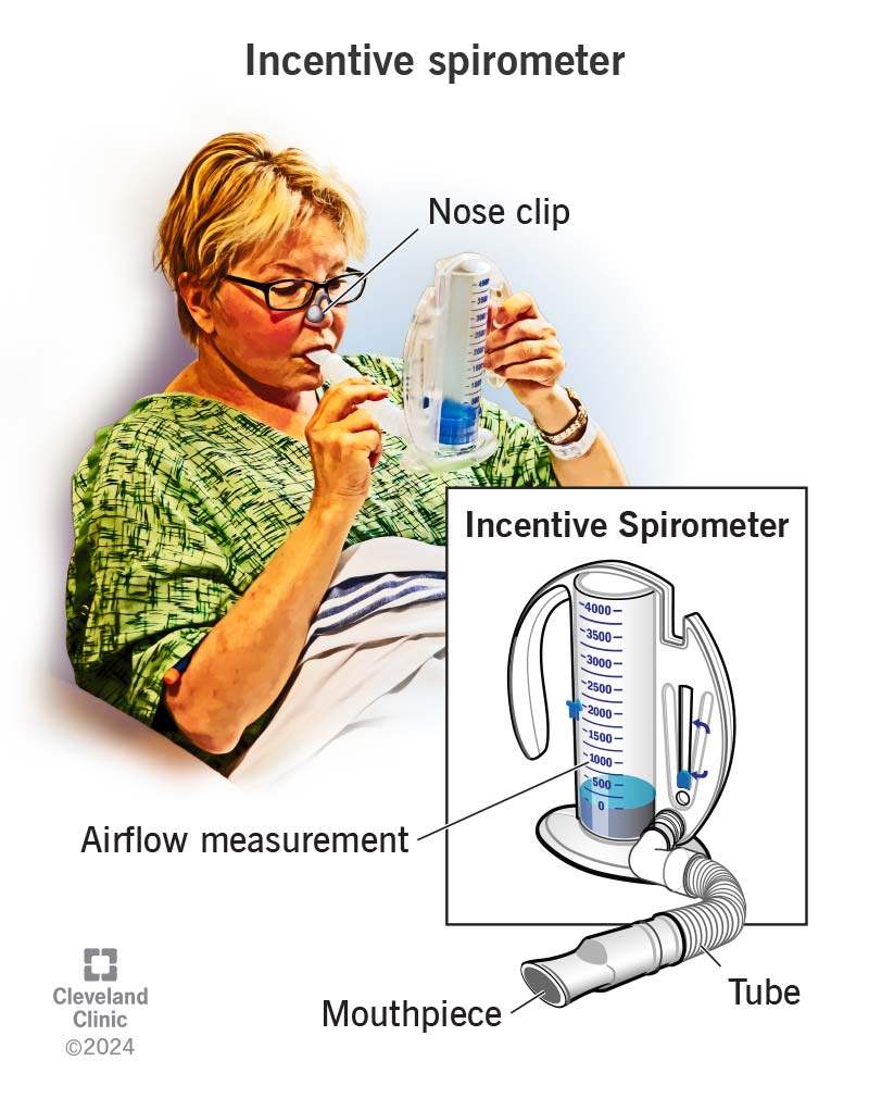 @md1talk 🔴Incentive Spirometry
مقياس التنفس المحفز
🔴يساعدك على تمدد رئتيك حتى تستطيع أخذ أنفاس عميقة كاملة.
🔴يساعدك على تمرين رئتيك وجعلهما أقوى أثناء التعافي بعد الجراحة.