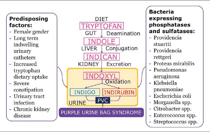 @NicoGagelmann Purple urine bag syndrome (PUBS) is rare disease entity, occurs predominantly in constipated women, chronically catheterized and associated with bacterial urinary infections that produce sulphatase/phosphatase. The etiology is due to indigo (blue) and indirubin (red) or to their…