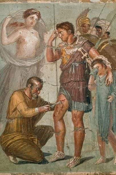 A Roman depiction from the Trojan War :

In this scene, the physician Iapix, aided by Venus, attends to the injury of Aeneas, while his young son Ascanius expresses his worry for his father through tears. 

This artwork is part of the wall frescoes found in the House of Sirico in…