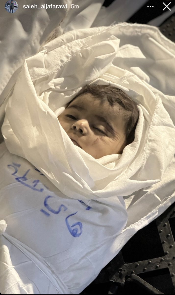 This child's name is Hani, he is seven months old. His parents died on the same day he was born. A few minutes ago, the Zionist terrorist occupation killed him by bombing a house in #Rafah
#Gaza 
#Gaza_in_Genocide 
#IsraeliNewNazism 
#IsraelGenocida 
#IsraelisISIS