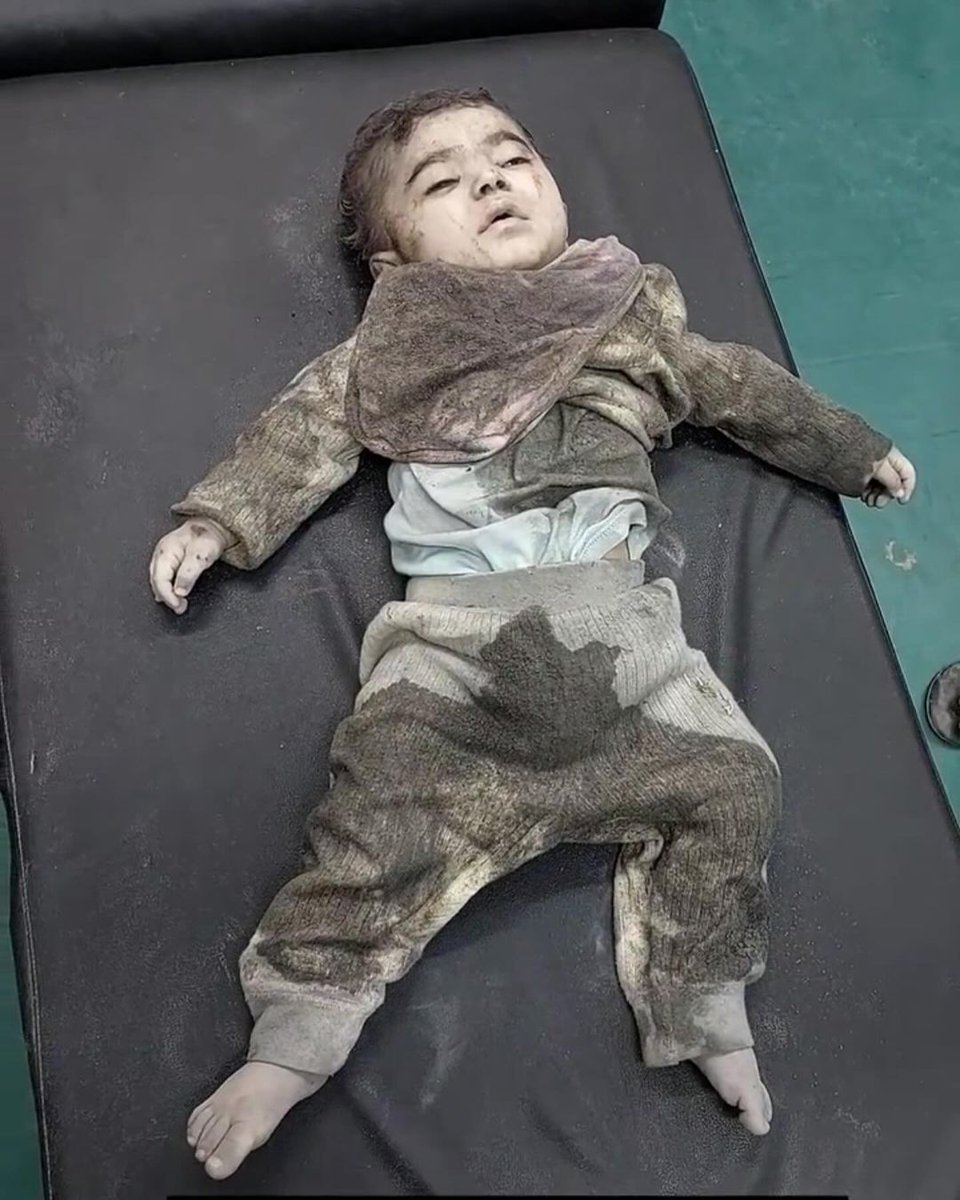 Gazze anlık.. Terörist İsrail'in saldırılarında bir bebek daha şehit oldu. Gazze hakkında konuşmayı bırakmayın