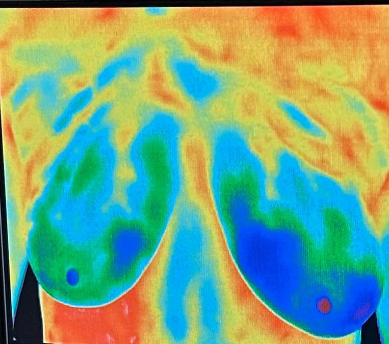 Ladies there are other options than getting your boobs smashed in mammography. Shelly Rose at Hot Shots Thermography is one of those options. #TeamNeedham #mammogram #mammography #thermography #womenshealth