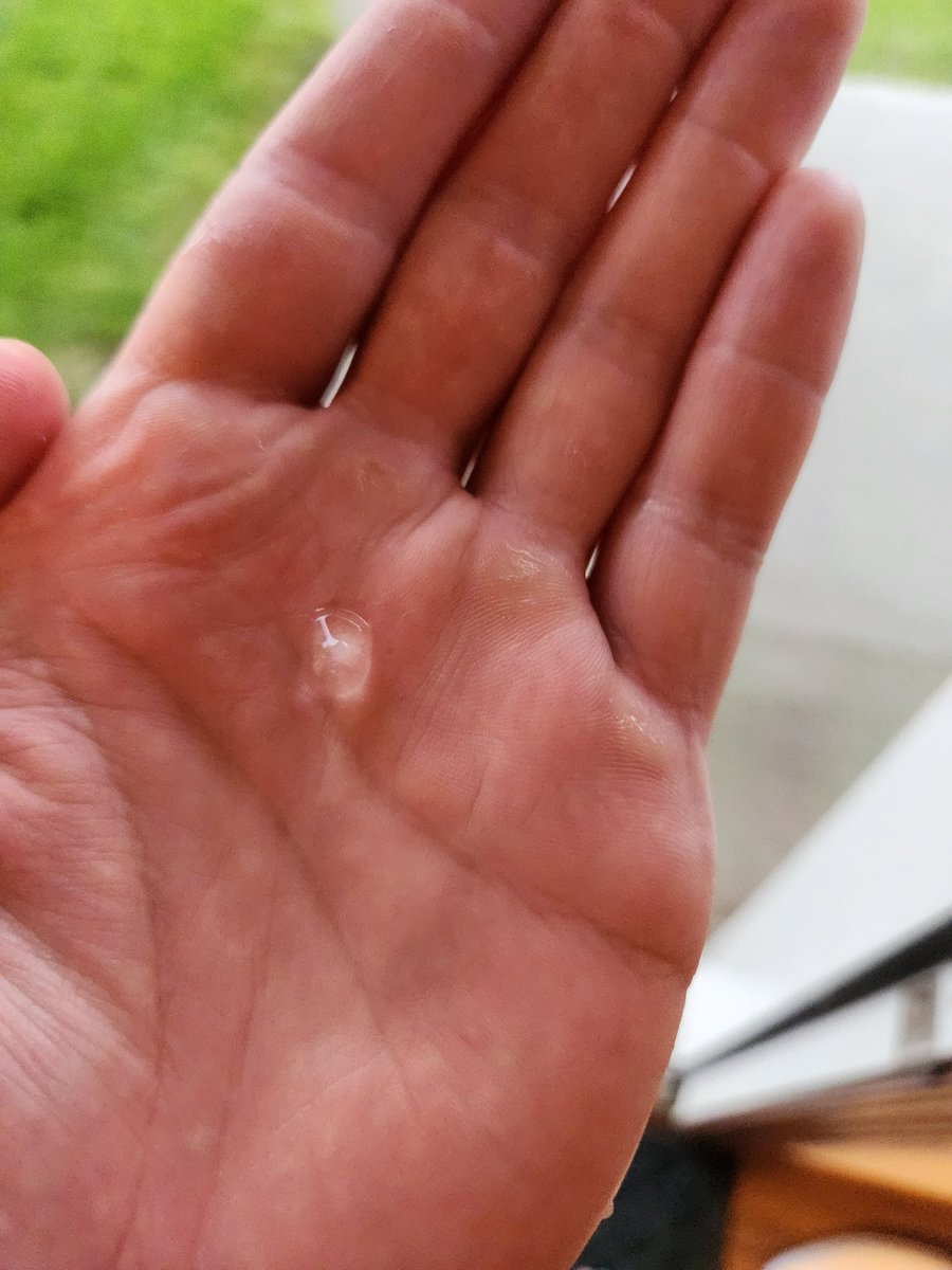 Pea-sized hail within the thunderstorm that is currently over Triadelphia, West Virginia. @NWSPittsburgh @tyler_vangi