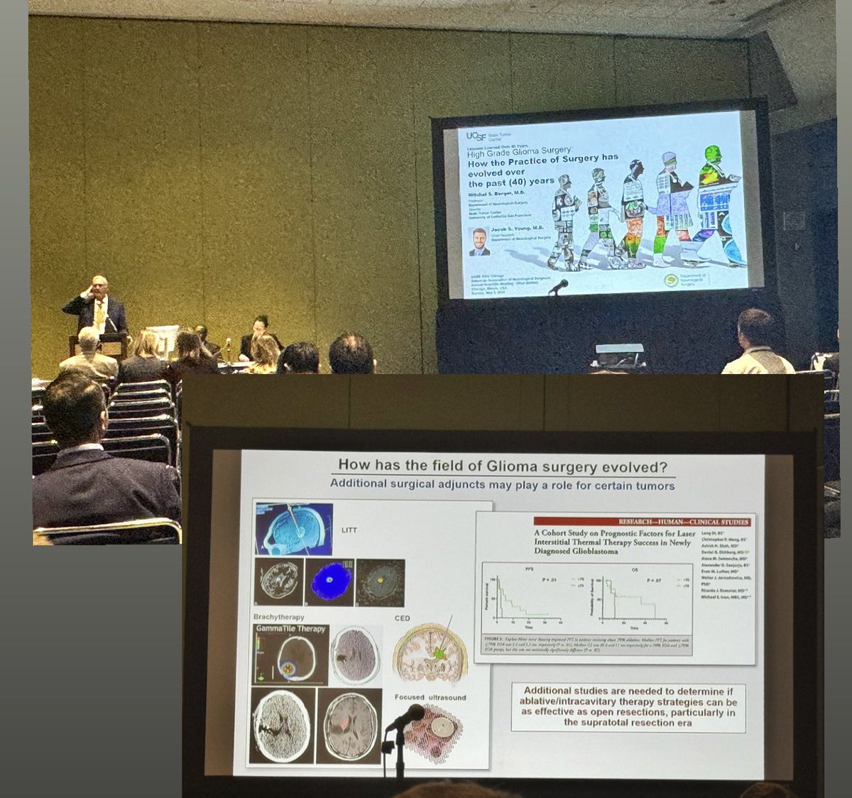 Dr. Berger discussing how far we have come in the treatment of gliomas in the past 40years today at the #AANS2024 citing some of the pivotal work on we have done on laser treatment @UMneurosurgery 🙏🙌