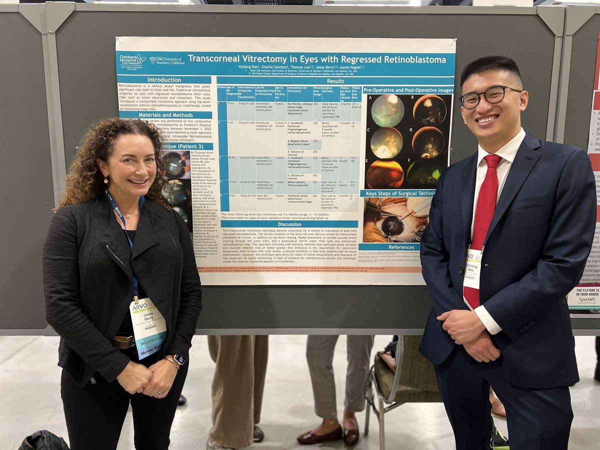 Check out our poster describing our technique for transcorneal vitrectomy in eyes with regressed retinoblastoma!