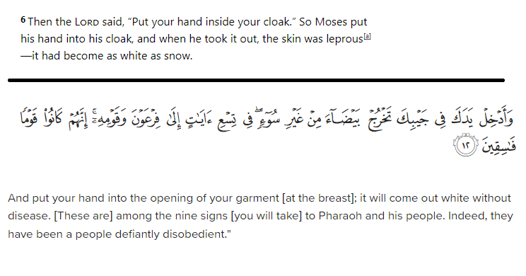 The Bible corrected by the Quran.

Exodus 4:6
Al-Naml 12