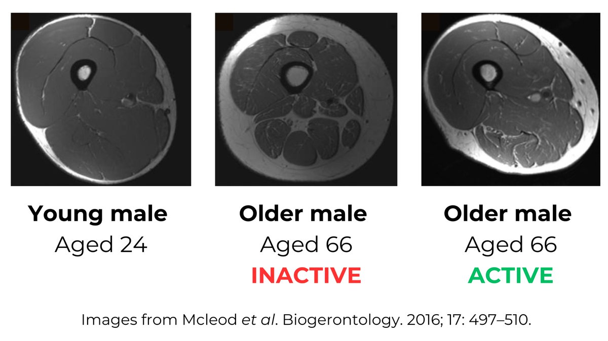 With ageing, muscles don’t just get smaller. Their very composition changes as well. And this has big implications for our ability to perform daily tasks, independence, and quality of life. But some older adults have shown it’s possible to turn the tables on muscle ageing:…