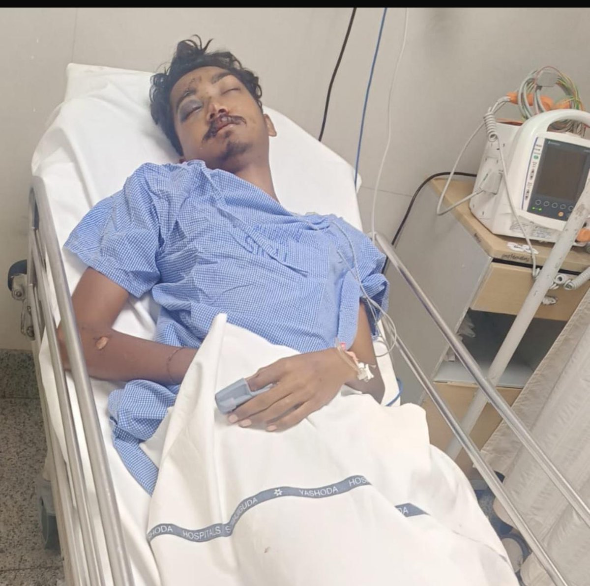 BhaskarNaredla2's tweet photo. His Name Varshith He Met With an Accident on May 4 2024 admitted in Yashoda Hospital Somajiguda I Jad Multiple Injuries 
@TeenmarMallanna @milaapdotorg 
Please Help Him For Speedy Recovery https://t.co/WTb32gX4ww