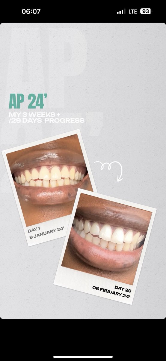 Ap24 whitening toothpaste No peroxide, non abrasive, removes stains! Cleans out coffee and cigarette stains leaving your teeth bright and clean Safe for kids Whatsapp 0783400204 🚚 Nationwide