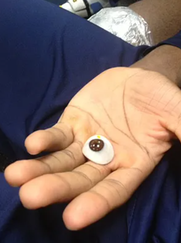 0ftalmologia's tweet photo. Un paciente recibe la primera #prótesisocular impresa en 3D de la historia.
👁‍🗨
https://t.co/CIwc6FfuNw! 

#protesisoculares #protesis #tridimensional #ojo #opticadigital #especialidadesopticas https://t.co/pcou3f61Lk