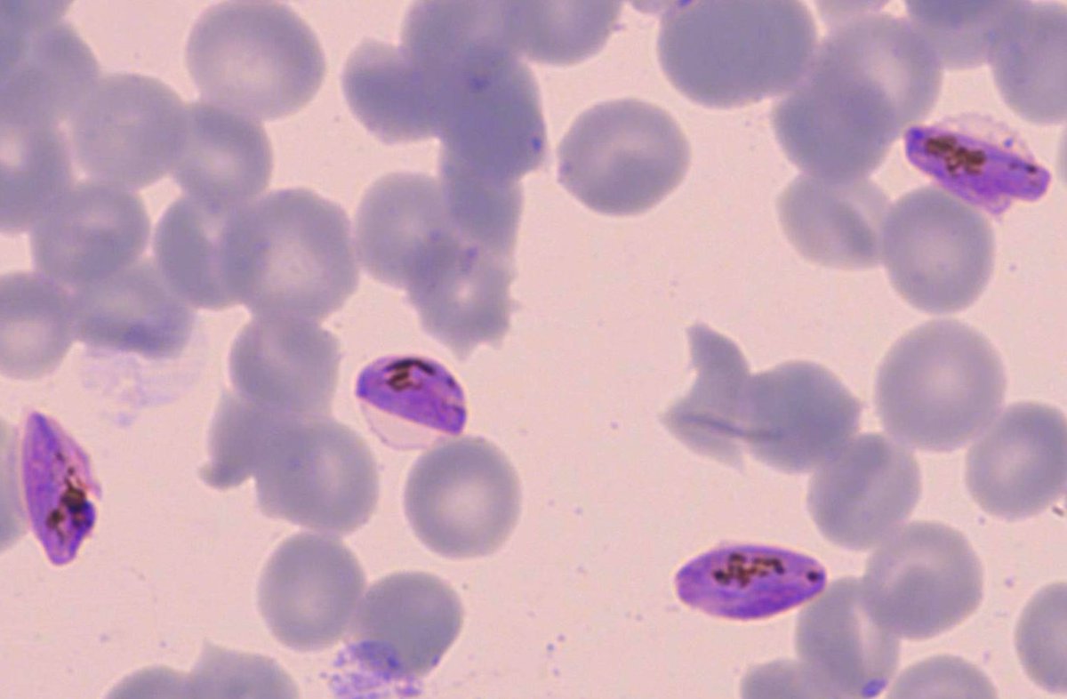Looking for a #ResearchTechnician to join us @IGCiencia! If you're interested in studying how malaria gametocytes remodel their host cell, join our @WellcomeTrust funded project by applying here: euraxess.ec.europa.eu/jobs/230940 Deadline 23rd of May. Please RT!