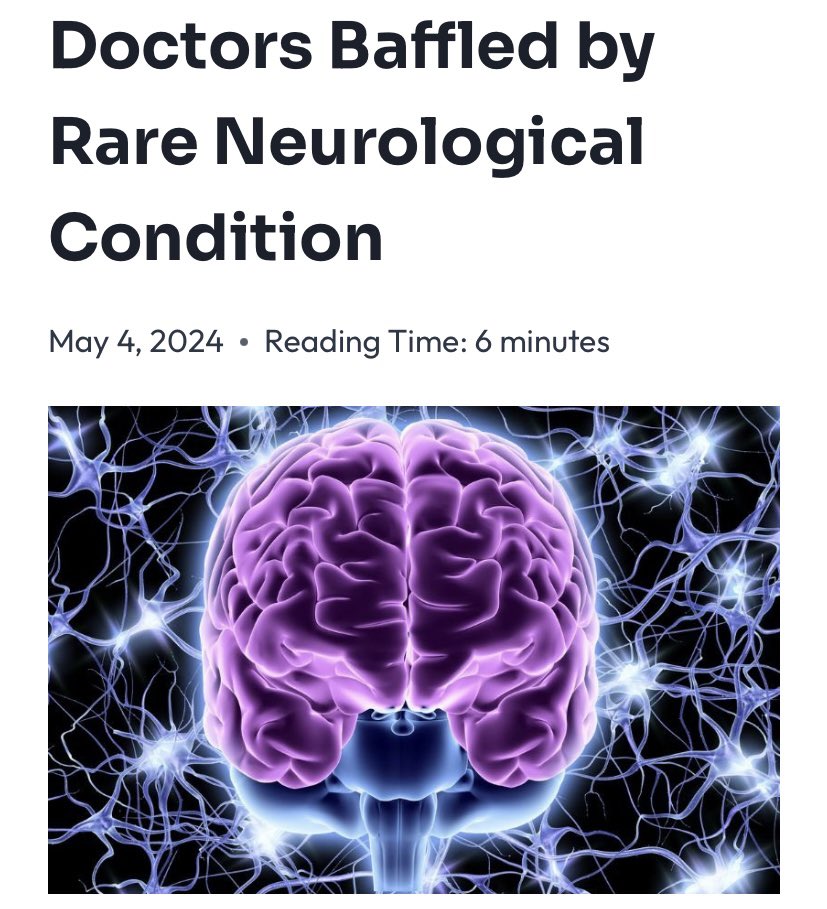 “Rare neurological condition leaves 17-year-old unable to walk” We have noted yet another mainstream media article discussing a mystery illness in a young man that has doctors baffled and unable to figure out what is going on – maybe an elusive virus… “The cause is thought to be…