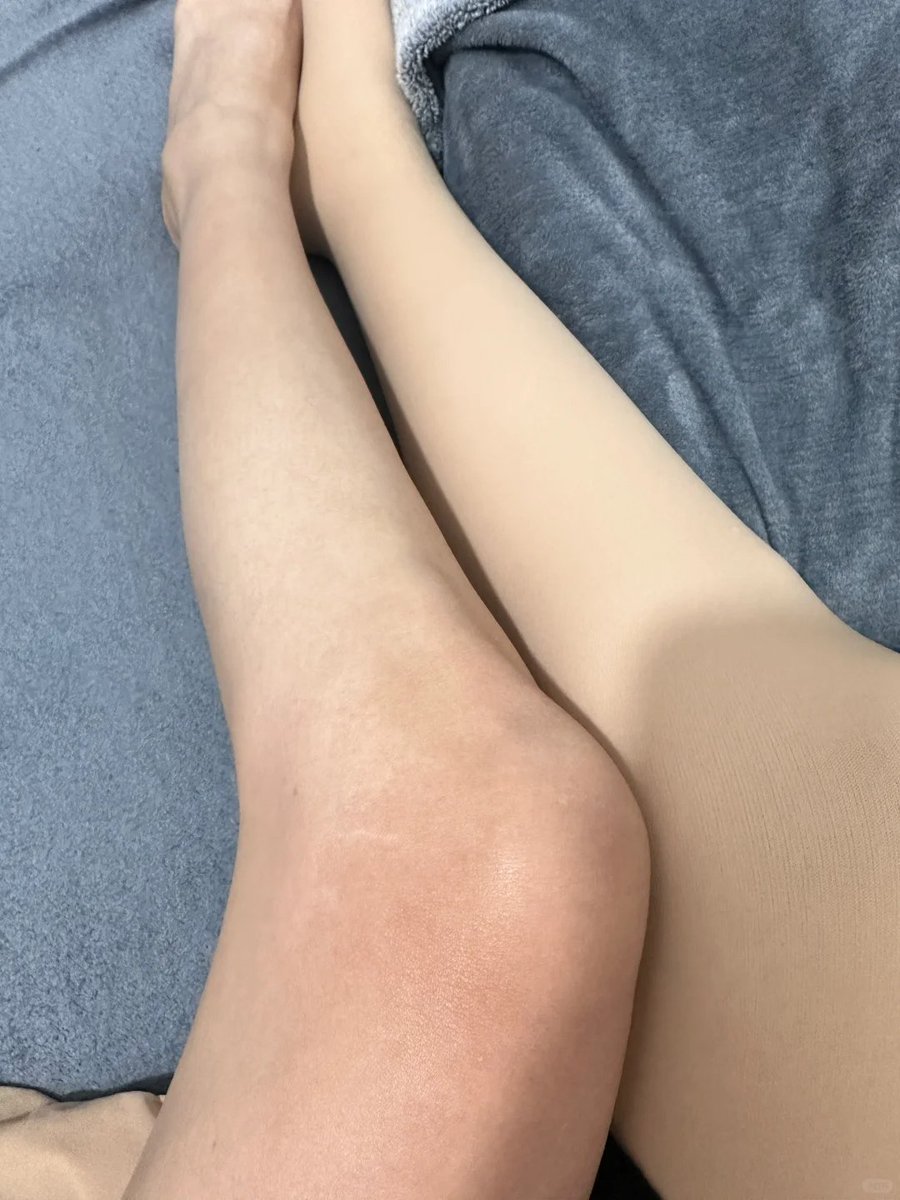 My legs may have been tired for a day, but my heart is full of expectations and longings for the future. Perhaps, we can let our feet rest, but the pursuit of dreams will never stop   #willnever #footrest #legs #leg #bestday #heartfeltmoment #future #feet #rest #dreams #befull