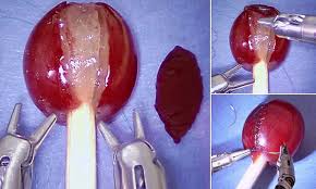 GrapeOnSol's tweet photo. grape surgery on solana https://t.co/0Qe2R9jpXu