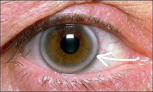 Spot diagnosis.
#MedTwitter #medtr #media #MedEd