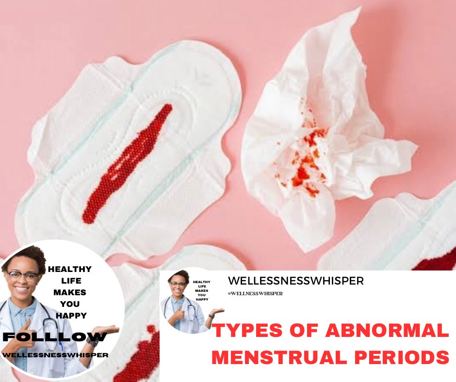 Abnormal menstrual periods can include various irregularities such as:

Amenorrhea
Menorrhagia
Metrorrhagia
Dysmenorrhea 
Polymenorrhea
Anovulation
Menstrual spotting
Postmenopausal bleeding #menstrualcycle #bleeding #periods #women