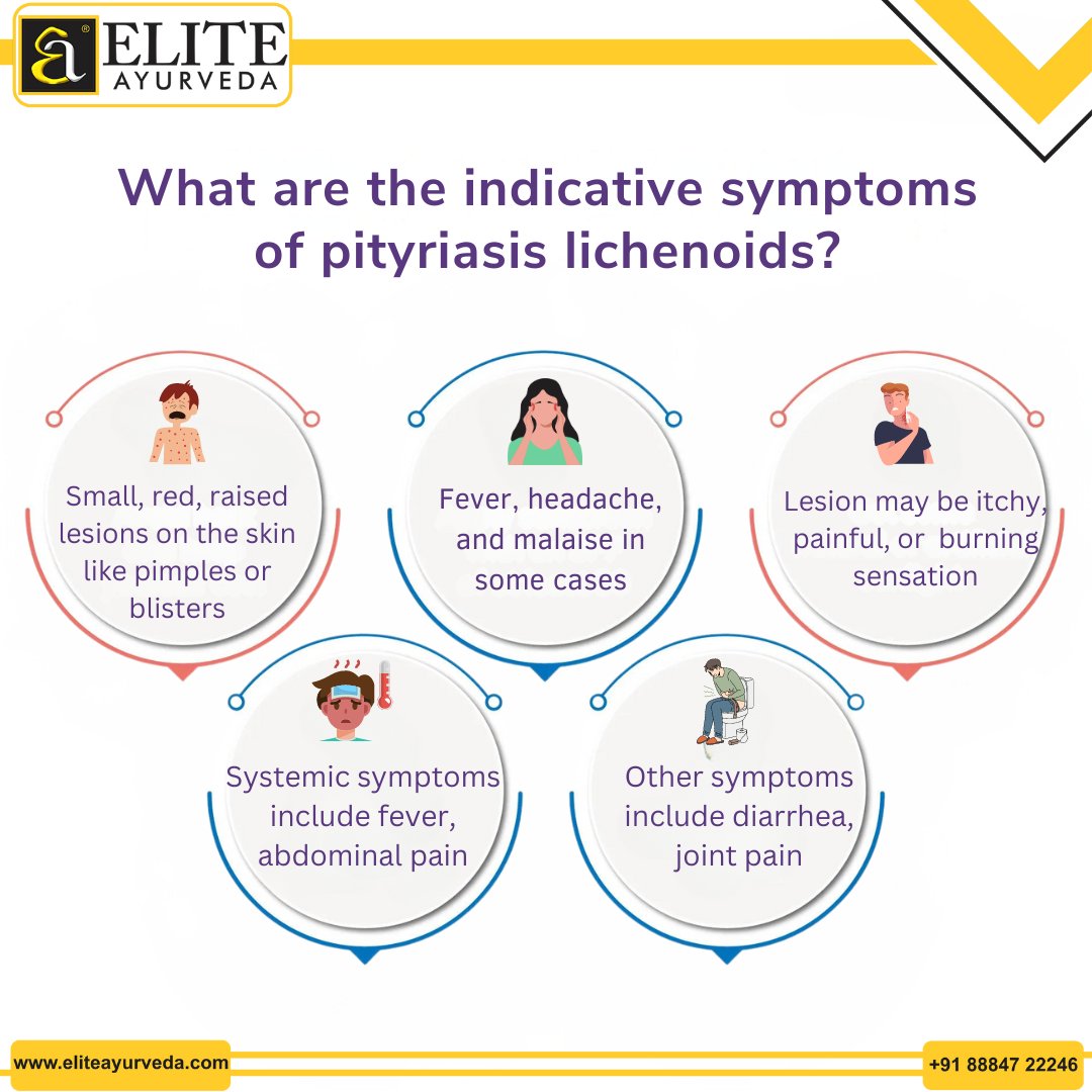 Pityriasis Lichenoides is a skin disorder identified by tiny, elevated pink patches that aggregate in clusters. It is not a contagious disease.
#pityriasislichenoides #metabolism #autoimmunedisease #SkinAwareness
To know more, visit bit.ly/3v9K5Y0