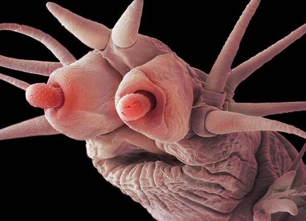electron microscope image of a deep ocean worm