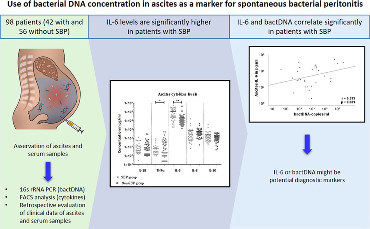 Original Research🔬 Use of bacterial DNA concentration in ascites as a marker for spontaneous bacterial peritonitis By Aehling et al 🇩🇪 @CorneliusEngel7 @ThomasBerg24 #LiverTwitter #GITwitter jcehepatology.com/article/S0973-…