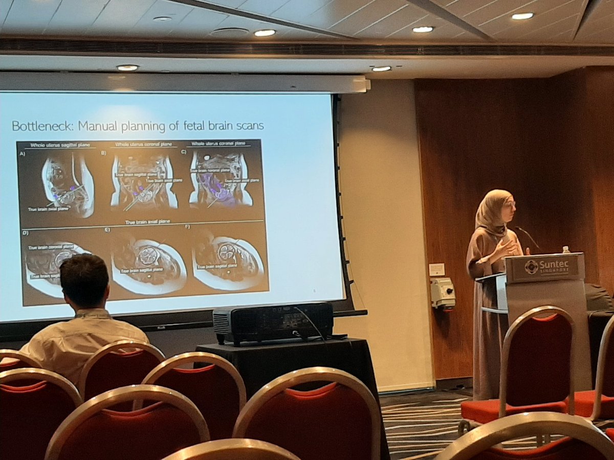 Sara presenting her autoplan work @  #ismrm2024 !