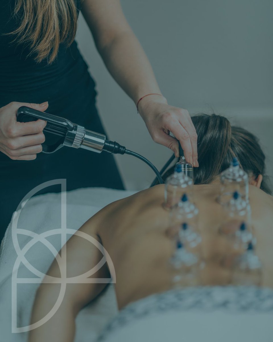 Cupping therapy, when incorporated into massage sessions, offers several potential benefits: 1.Pain Relief 2. Improved Range of Motion 3.Stress Reduction Adding cupping therapy into a massgae can help reduce stress, anxiety, and tension, promoting a deep sense of well-being.
