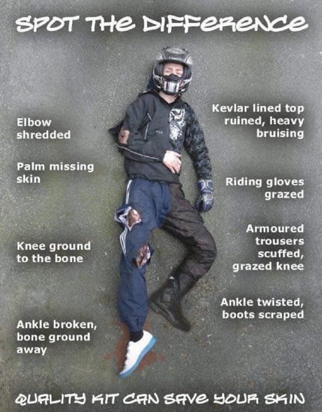 T-Shirts, Jeans, Shorts, Trainers & not wearing Gloves provides ZERO protection if you come off your motorcycle Wearing a good quality Helmet & the correct protective equipment & clothing will literally save your skin #CheshireFire #MotorcycleSafety 🏍️ 🚒