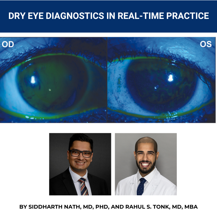 Ophthalmologymg's tweet photo. Drs. @RahulTonkMD @BascomPalmerEye + @Sid_Nath @mcgillu @Moorfields summarize some of the modern DED diagnostic tests+devices, consider how these may be integrated into routine clinical practice+review their version of the dry eye clinic appointment. https://t.co/bm84Kf4kNm. https://t.co/Z65Zb3xU1e