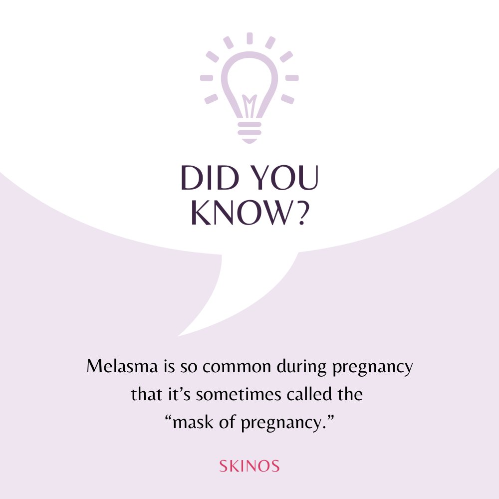 skinosclinic's tweet photo. Understanding Melasma, commonly known as the "mask of pregnancy" can be crucial for skincare enthusiasts. Illuminate your knowledge to unveil the truth behind Melasma with us.
#Melasma #SkinCare #SkinHealth #Skinos #Dermatologist #DrShrutiGupta #DrSandeepKumar #SunScreen #Summer https://t.co/XnTqDyLS9B