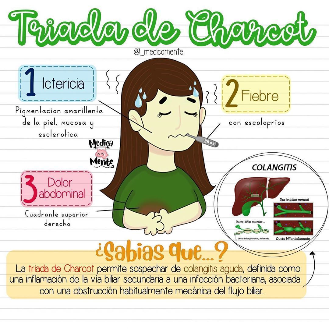 Tríada de Charcot Presentación, diagnóstico y terapéutica de la colangitis aguda buff.ly/4bsDOGL