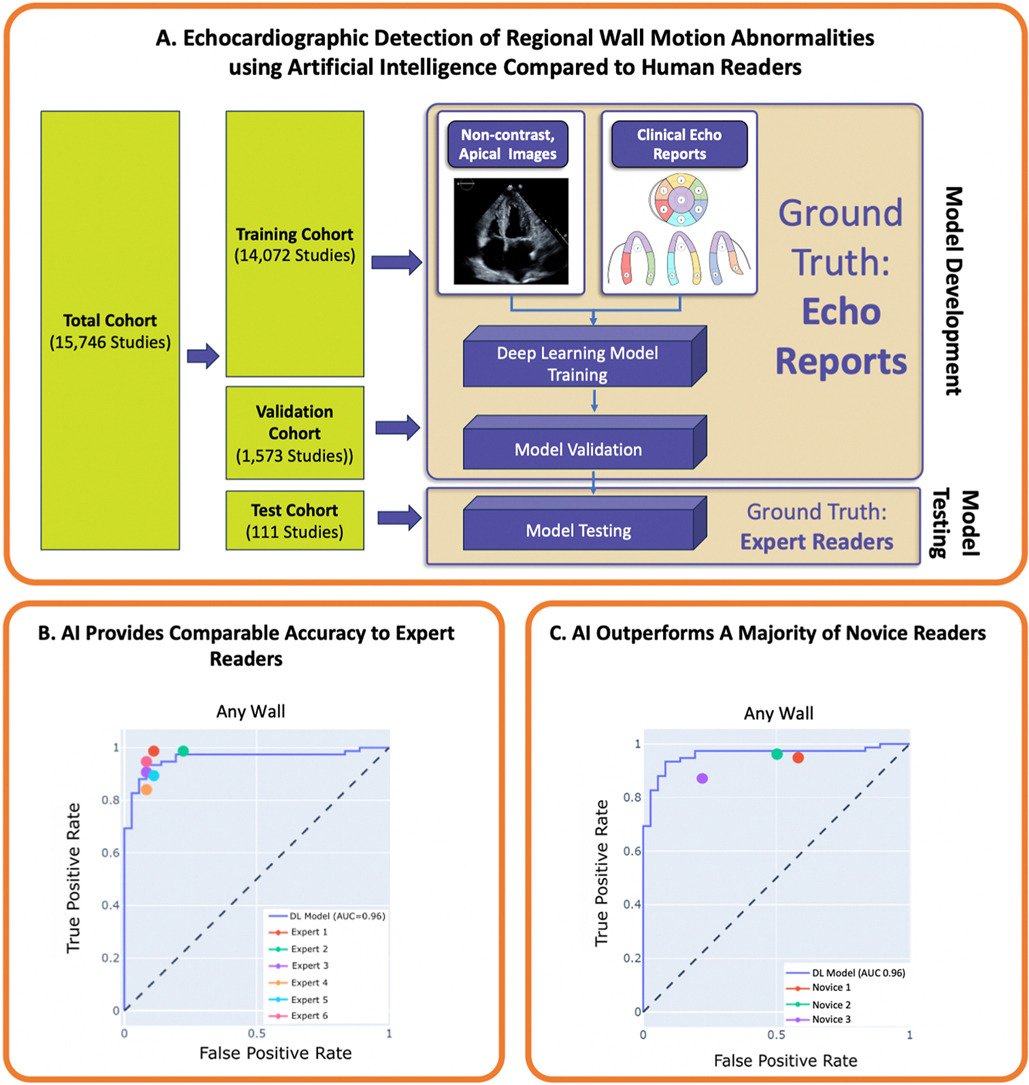 DL #Echofirst model for RWMA detection was comparable to experts and outperforms a majority of novice readers. Thank you to @JournalASEcho for opportunity and @robertomlang and the fantastic team at @Philips for their invaluable expertise. authors.elsevier.com/c/1j1Zu3BS3sb1…