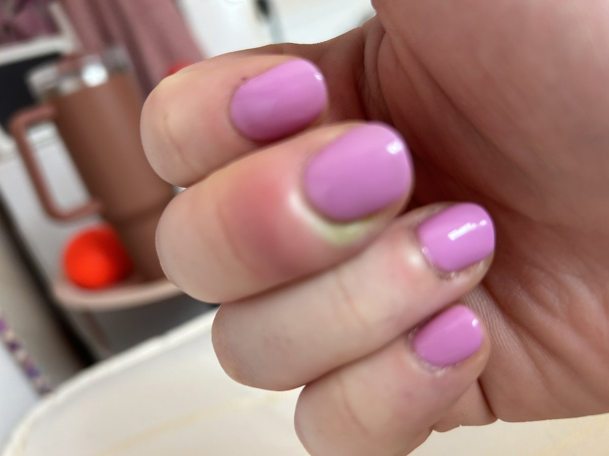 When you go to out of hours GP for an infected finger and they ask when your last period was… 🤔