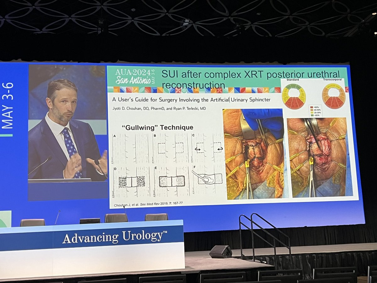 Liz Olive, MD (@olive_liz) on Twitter photo Radiation-induced posterior urethral stricture — <a href="/boyd_viersMD/">Boyd Viers</a> describes his approach based on location relative to pelvic floor and +\- prostate in situ. Not all radiation strictures/stenosis are created equal! #AUA24 <a href="/MayoUrology/">Mayo Clinic Urology</a> <a href="/SocietyGURS/">GURS</a> Radiation-induced posterior urethral stricture — <a href="/boyd_viersMD/">Boyd Viers</a> describes his approach based on location relative to pelvic floor and +\- prostate in situ. Not all radiation strictures/stenosis are created equal! #AUA24 <a href="/MayoUrology/">Mayo Clinic Urology</a> <a href="/SocietyGURS/">GURS</a>