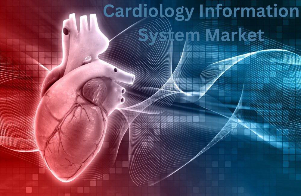 The Cardiology Information System (CIS) Market is booming with a projected growth rate of 8-10% from 2024 to 2029. download sample report: lnkd.in/d9E2GSAT

#Cardiology #CardiacCare #CardioCare #Medical #Healthcare