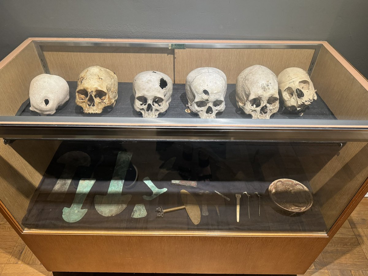 Congratulations <a href="/NeurosurgeryNM/">Neurosurgery at NM</a> and <a href="/Lurieneurosurg/">Lurie Children's Pediatric Neurosurgery</a> for 100 years!  Thanks <a href="/maciejlesniakmd/">Maciej Lesniak, MD</a> and <a href="/sandi_lam/">Sandi Lam</a> for a great party at the <a href="/IMSS_Chicago/">International Museum of Surgical Science</a>. I crashed the party as Peds Fellow ‘11  <a href="/abfoy/">Andy Foy</a>’s plus one.