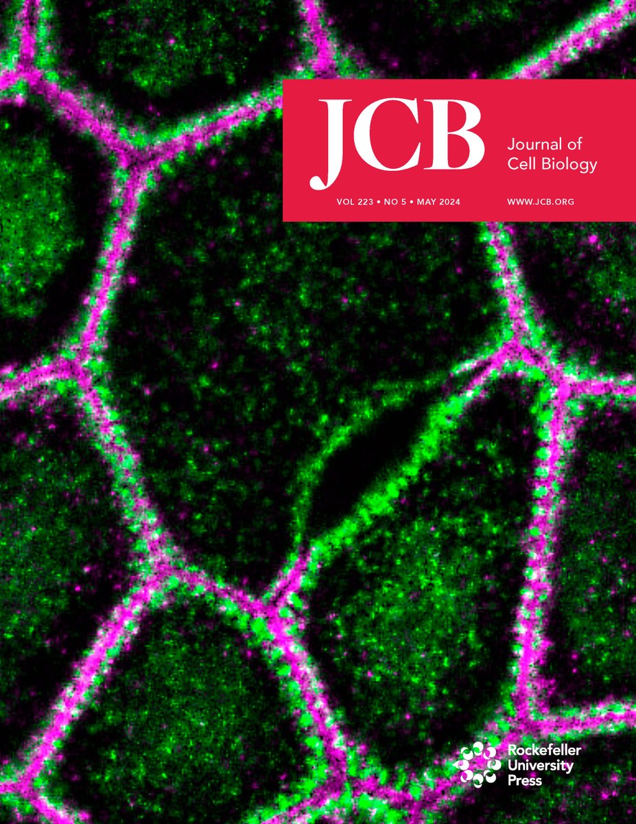 Our May Issue is out! ➡️ hubs.la/Q02vLlxR0
The cover shows STED microscopy image of myosin IIA (green) and ZO-1 (magenta) of claudin/JAM-A KO MDCK II cells. From @tann_nguyen, @tetsuotani1 et al. (hubs.la/Q02vLjf10)
